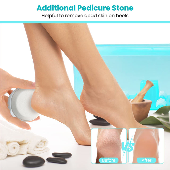 Giantex Foot Spa with Heat and Massage - Feet Bath Soak Tub w/Bubble, Vibration, Removable Pedicure Stone